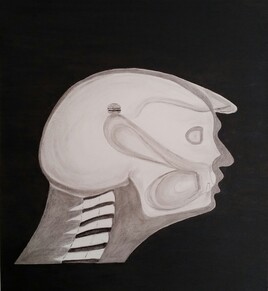 Donald, La radiographie