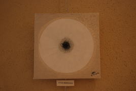 L'ictus amn&eacute;sique