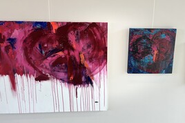 D&eacute;fibrillation