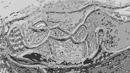 Psychedelic perversion