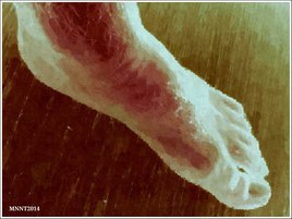 Mobile Photography and Cr&eacute;ativity."FOOT"