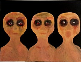 &Eacute;tat schizophr&egrave;ne